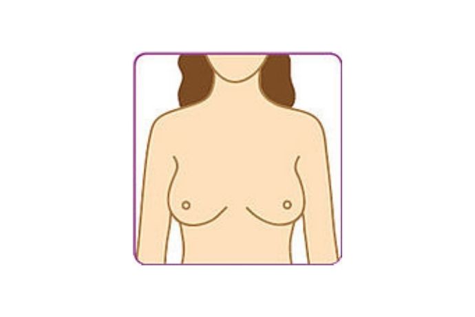 Brust abtasten - 1. Schritt
